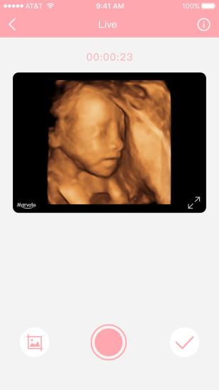 体内相机app图集展示